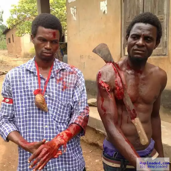 Remember the photo of a guy slashed with a cutlass & still posing for a photo? It
